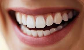 روش های دندانپزشک زیبایی
