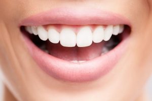 روش های دندانپزشک زیبایی - زیبایی دندان